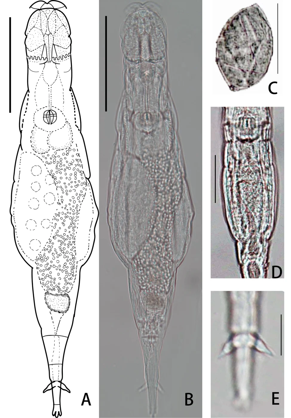 Adineta acuticornis