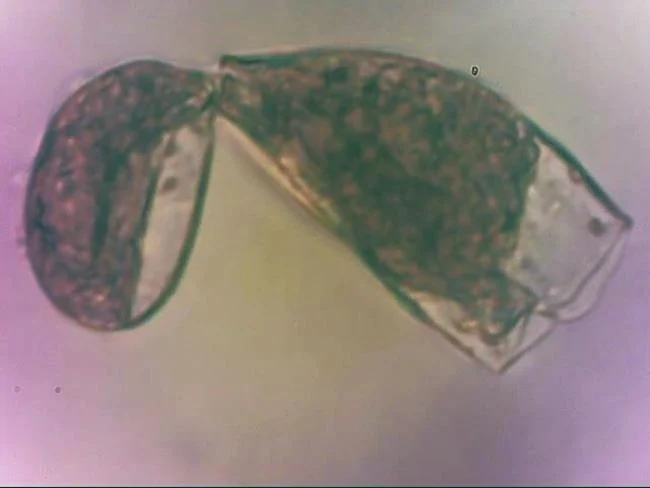Anuraeopsis fissa