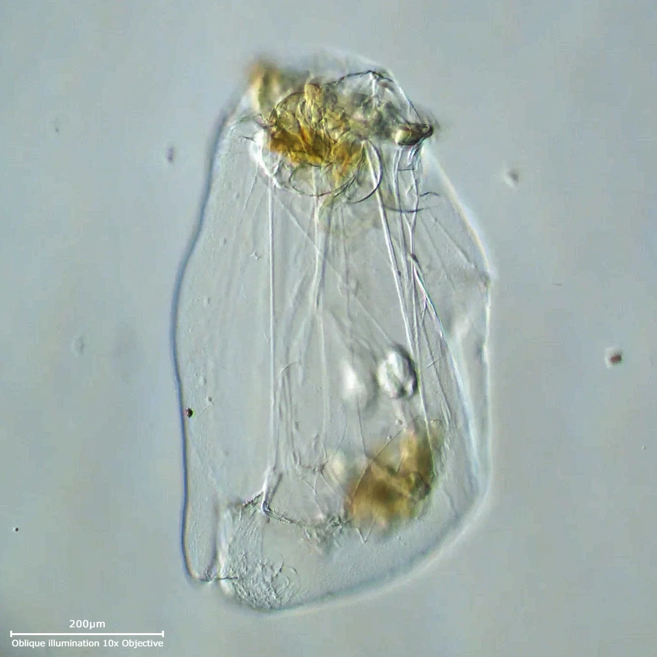 Asplanchna girodi
