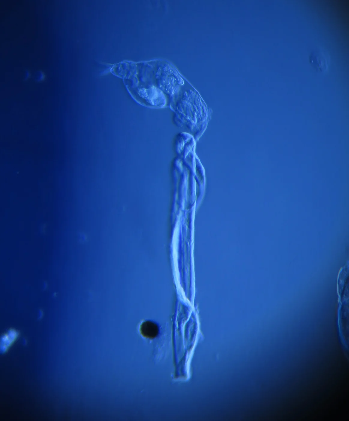 Cephalodella tecta