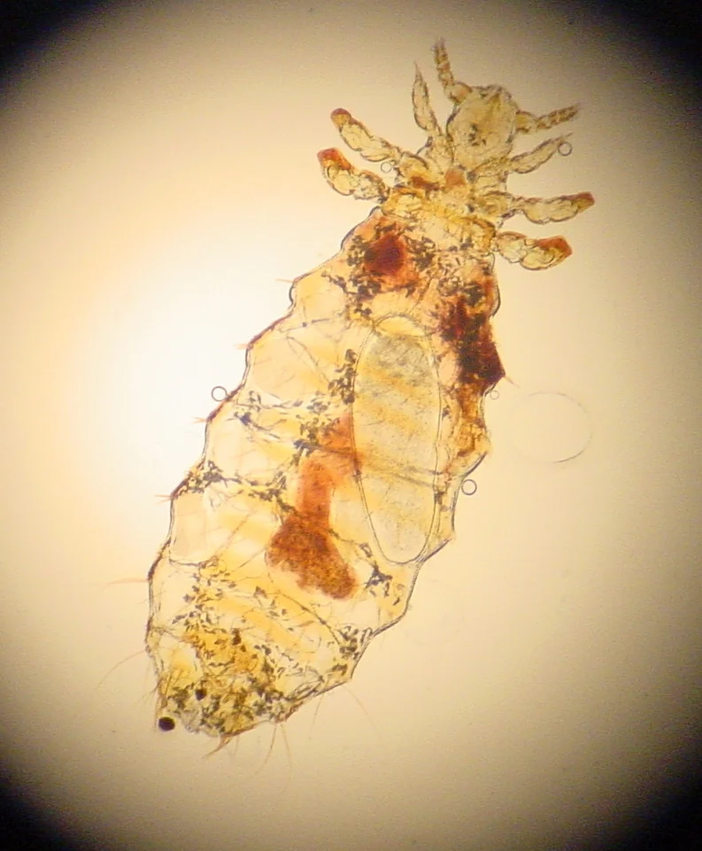 sucking louse