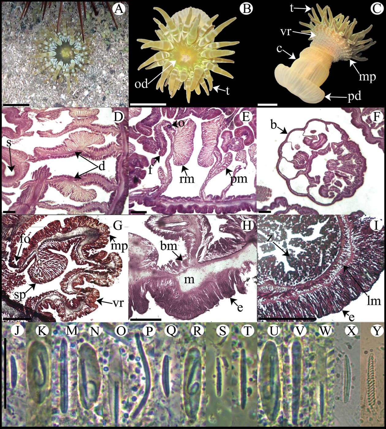 Isoaulactinia stelloides