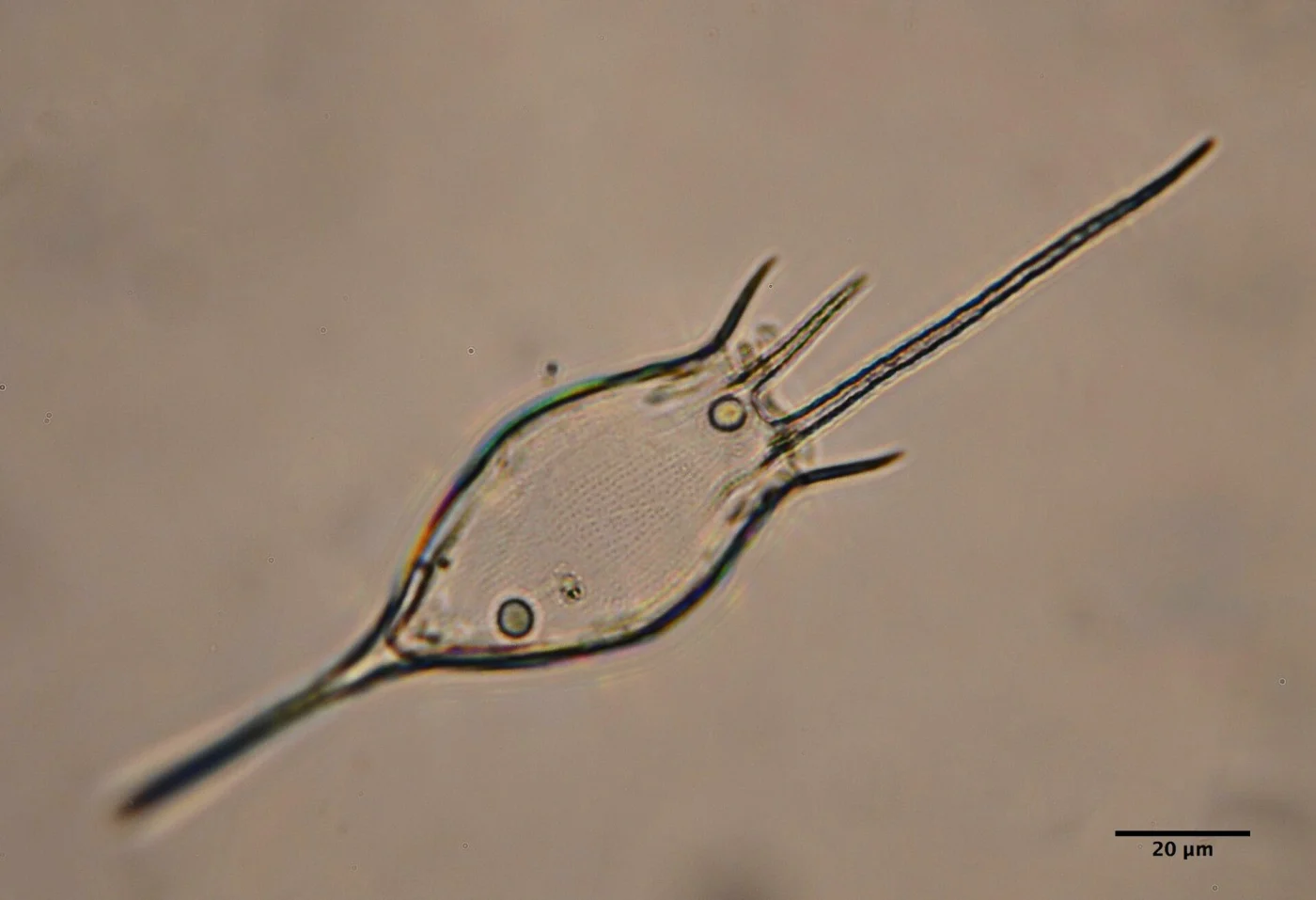 Kellicottia bostoniensis