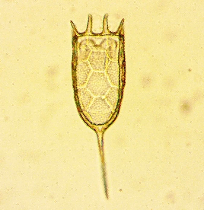 Keratella americana