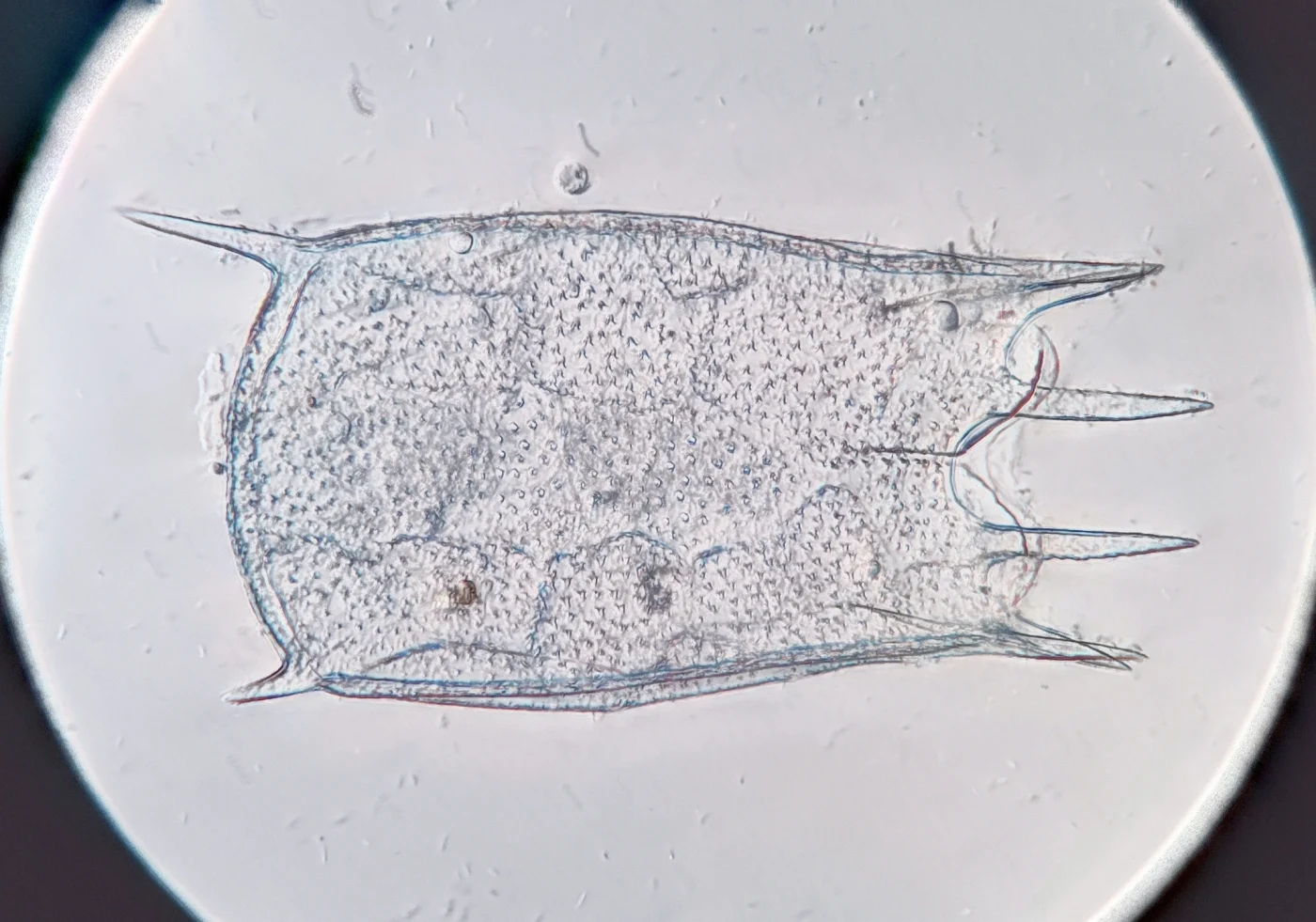 Keratella hiemalis