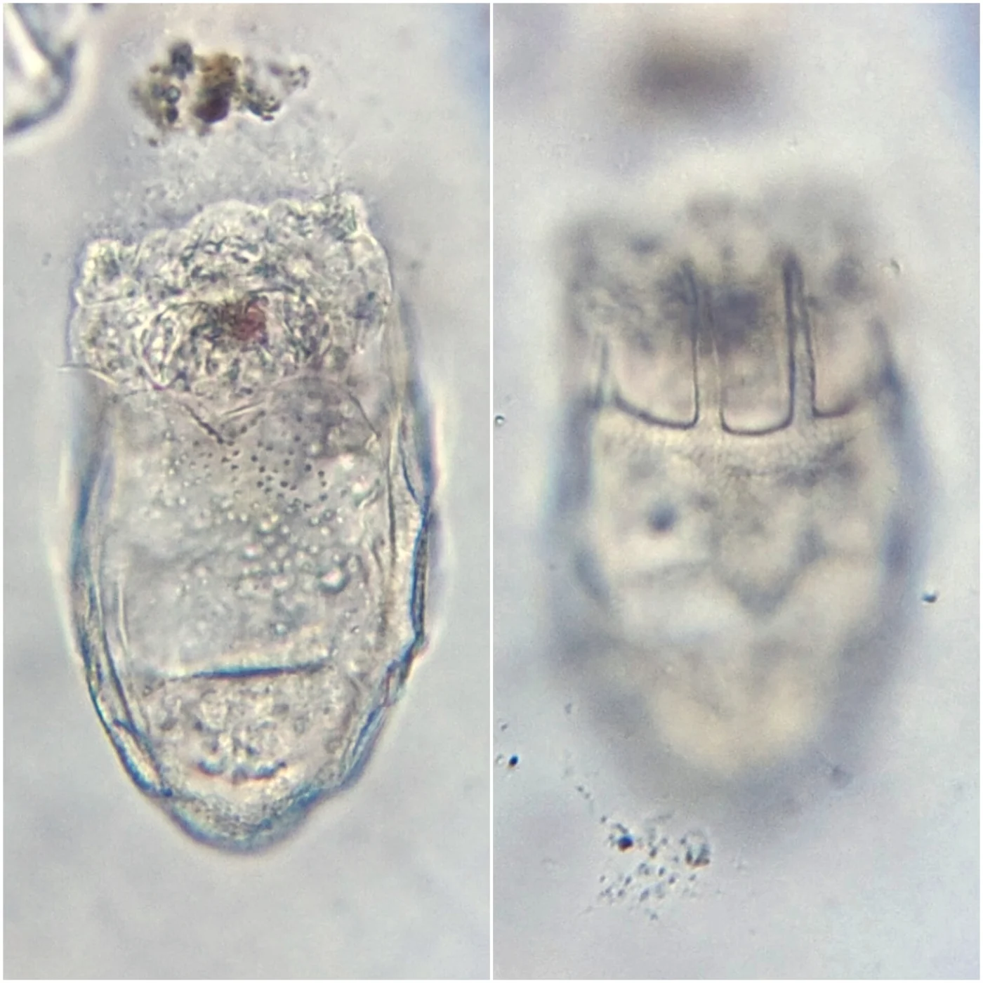 Keratella tecta