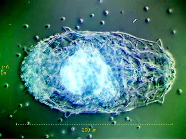 Kostea wockei