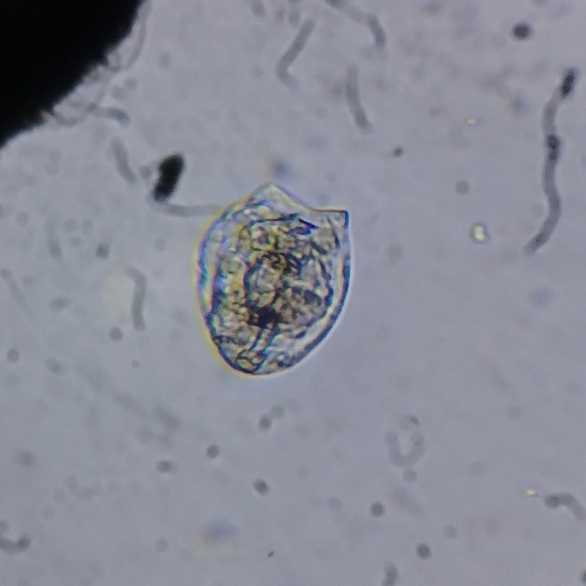 Lecane closterocerca