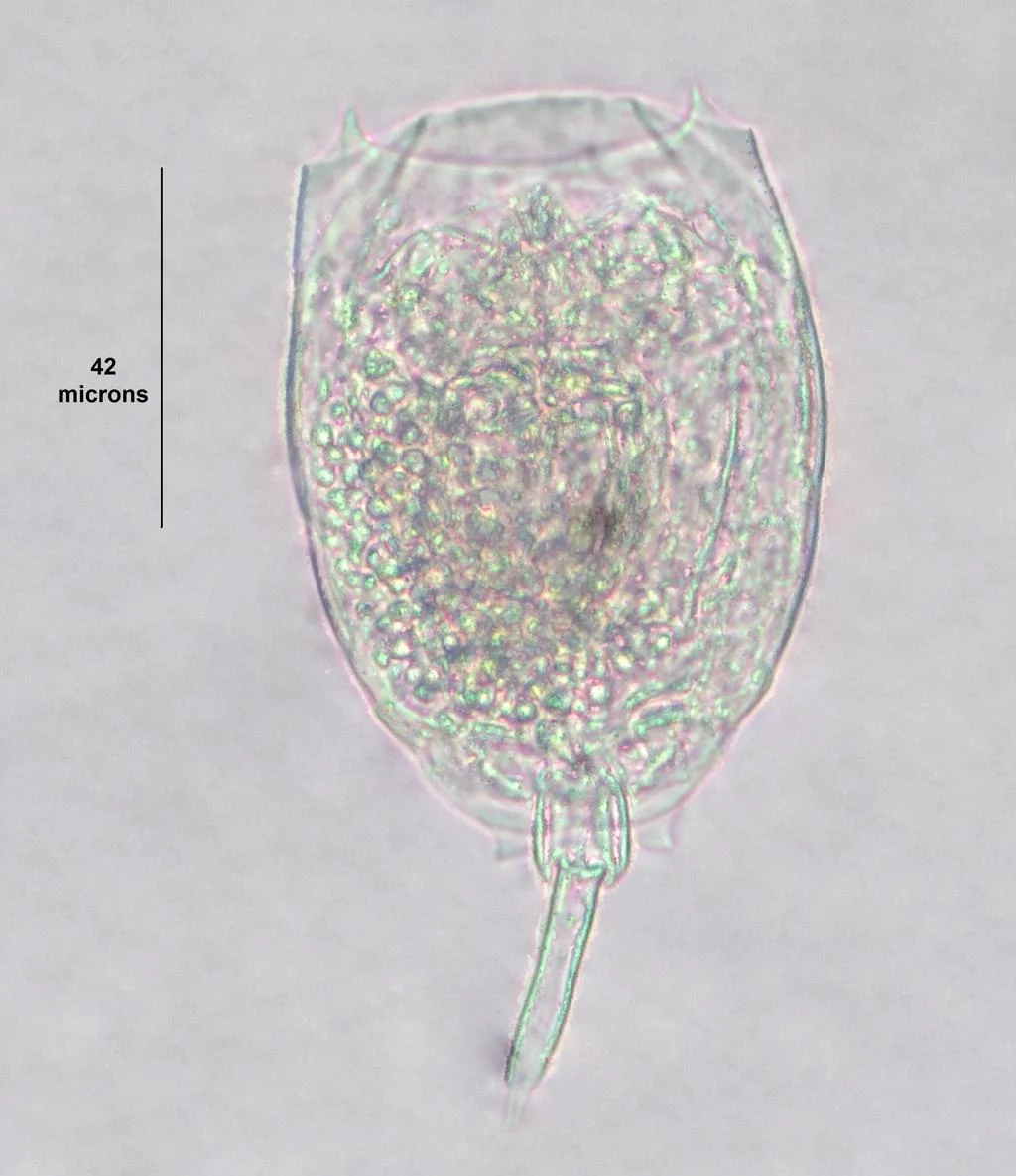 Lecane spinulifera