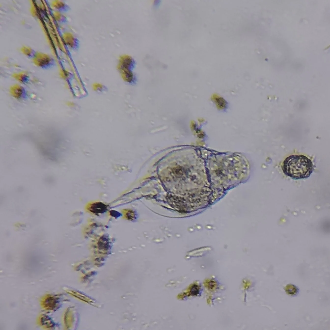 Lepadella acuminata