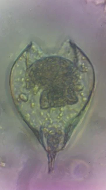 Lepadella quadricarinata