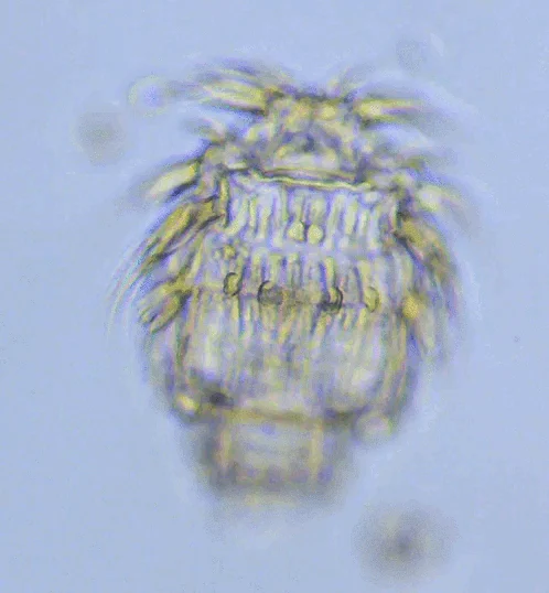 Macrotrachela zickendrahti