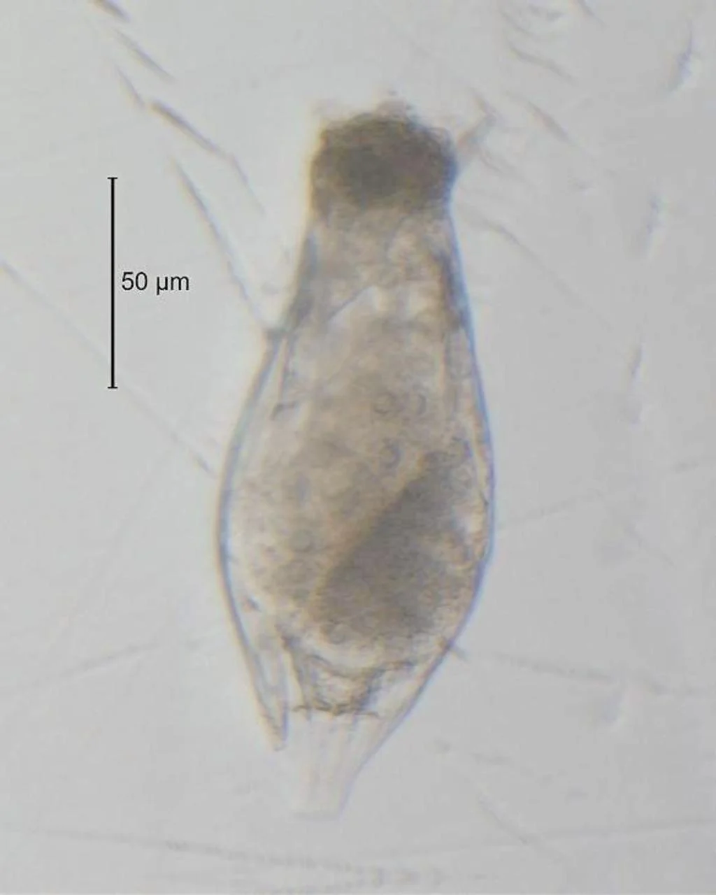 Notholca acuminata