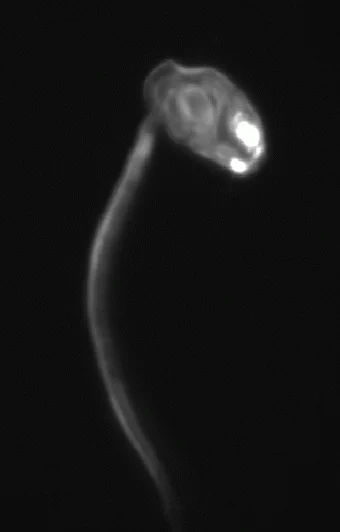 oikopleura