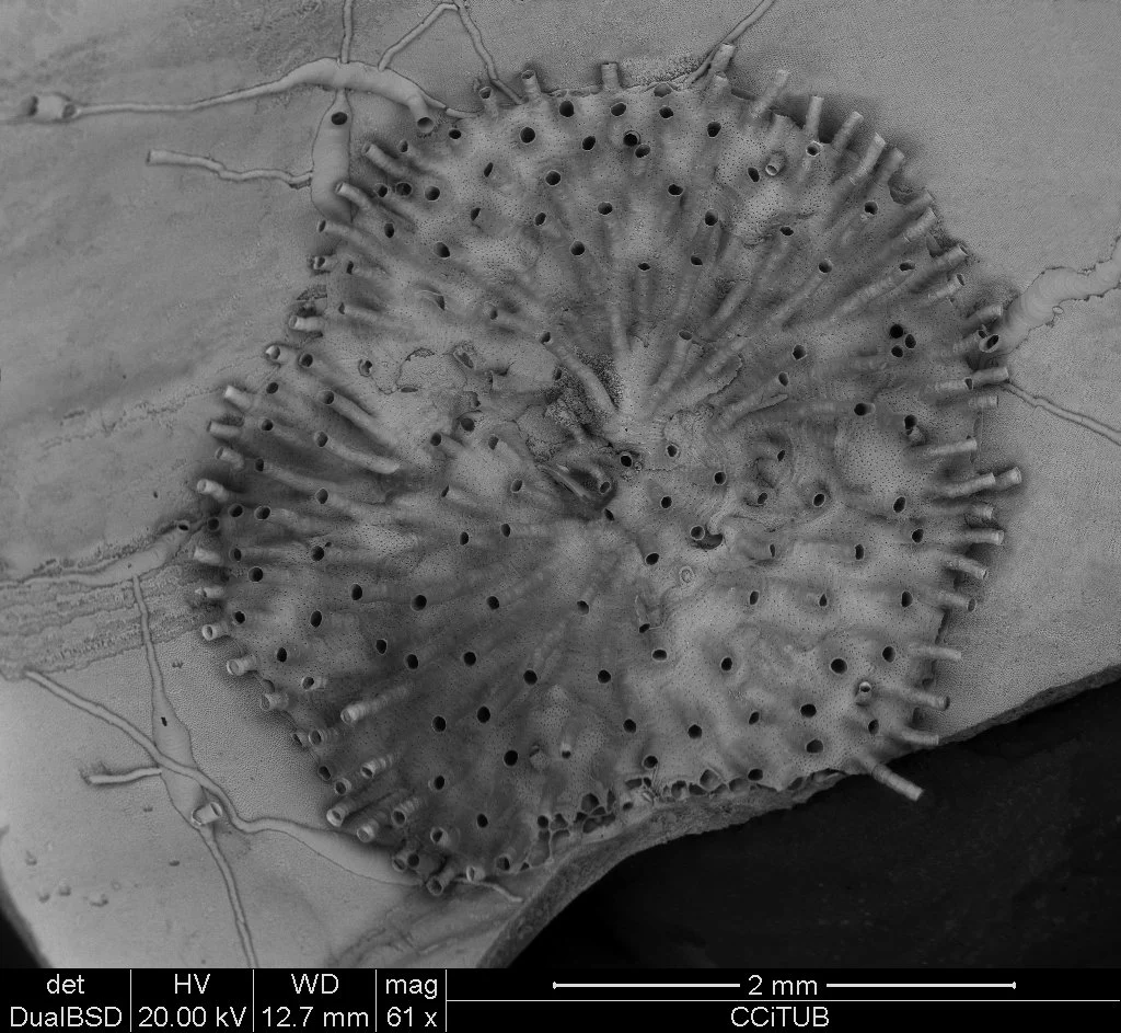 Oncousoecia dilatans