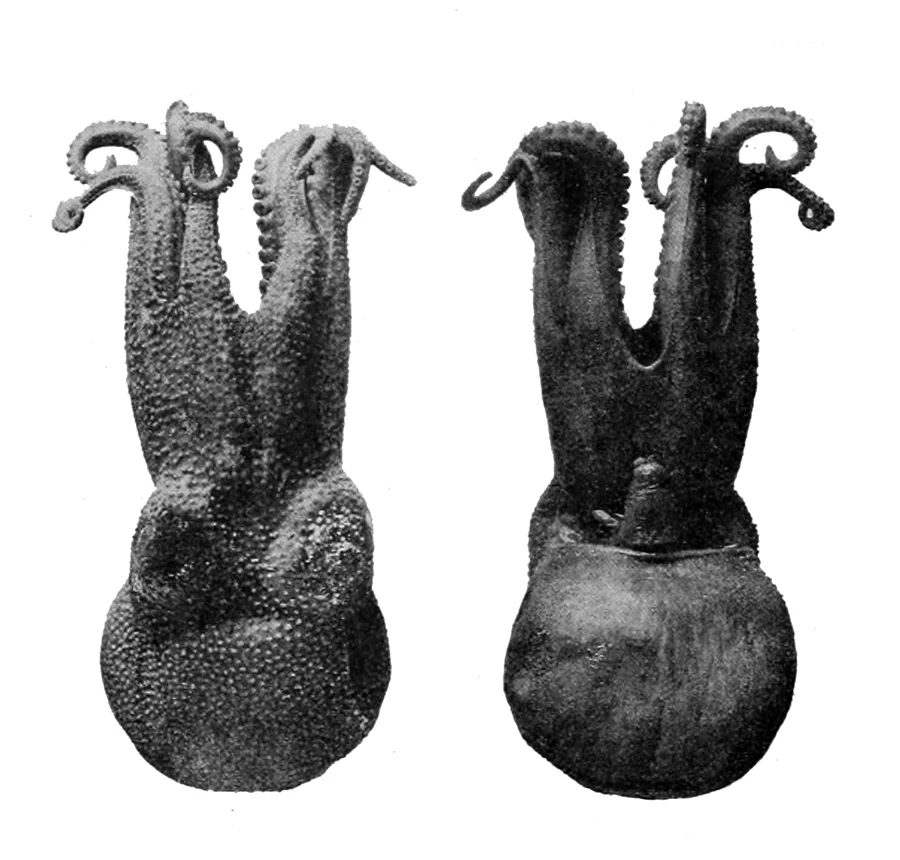 Charcot's Octopus
