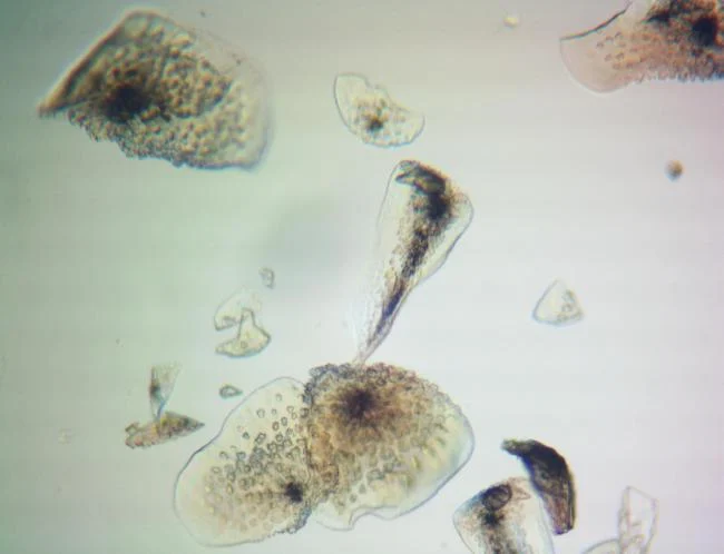 Pseudoplumarella filicoides