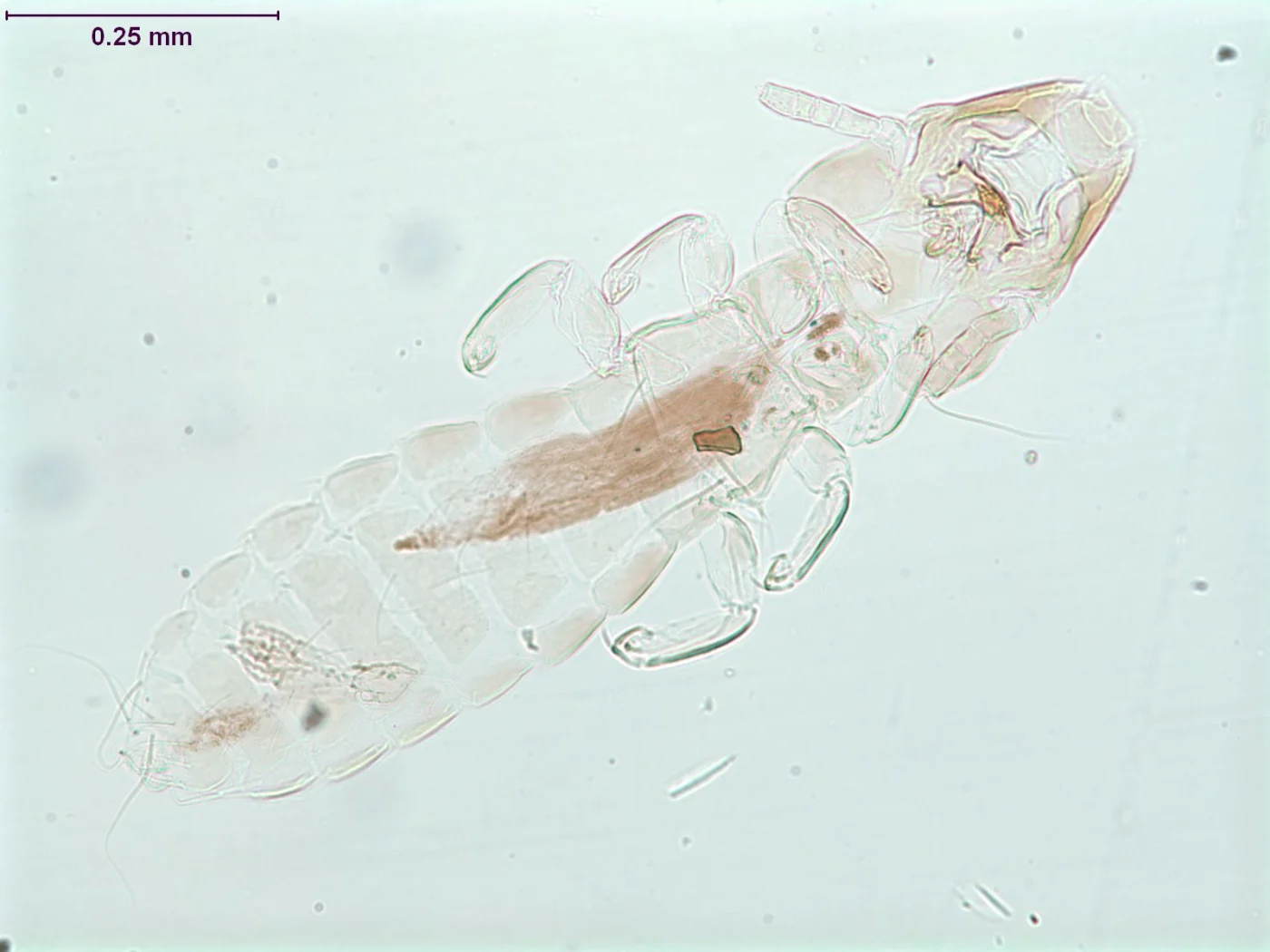 Quadraceps separatus