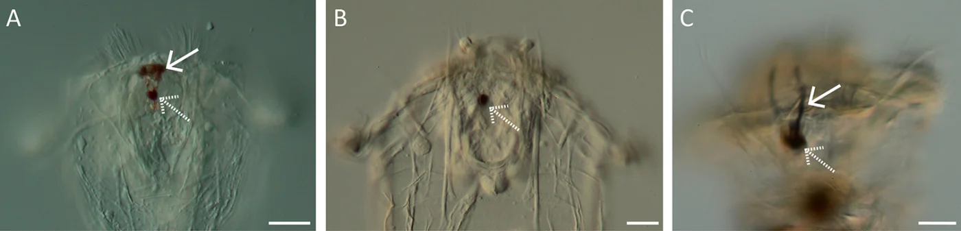 Synchaeta triophthalma