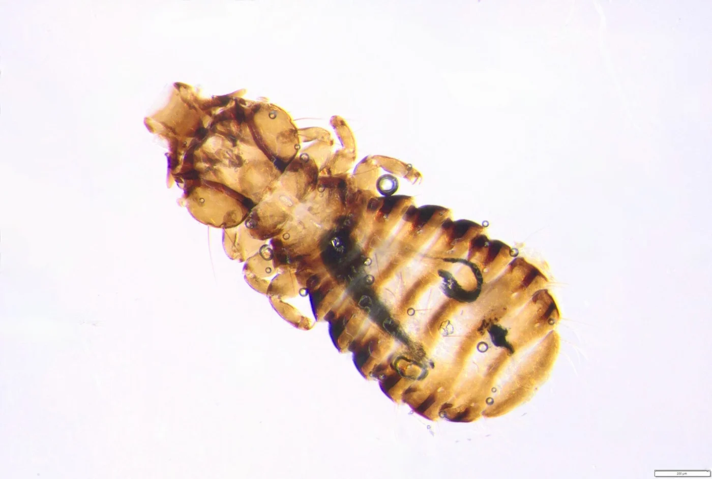 Trabeculus hexakon