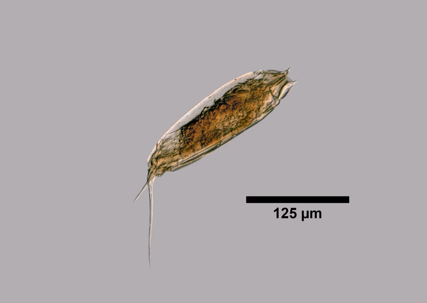 Trichocerca edmondsoni